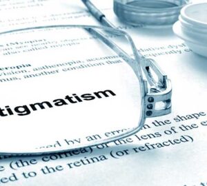 Astigmatisme